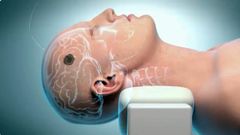 Terapia contra los tumores cerebrales investigado por el asturiano Juan Fueyo