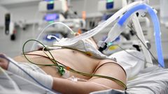 Paciente con covid ingresado en un hospital p�blico de Salzburgo