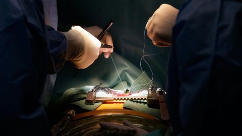 EQUIPO DE CIRUGIA CARDIACA INFANTIL Y CARDIOPATIAS CONGENITAS CON EL DR.PORTELA
QUIROFANOS
OPERACION
CHUAC
