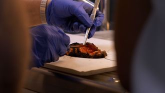 Biopsia intraquir�rgica en el serivicio de Anatom�a Patol�gica del CHUO.