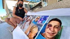 Lupe, la madre de Nacho, el joven agredido en la brutal paliza en Nigrn, con un cartel sobre las heridas de su hijo