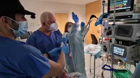 El HUCA incorpora la �ltima tecnolog�a de broncoscopia guiada por sonda ecogr�fica para el diagn�stico precoz del c�ncer de pulm�n.