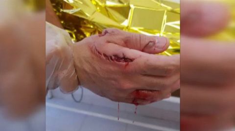 Un tirbur�n ataca a un ba�ista en Elche