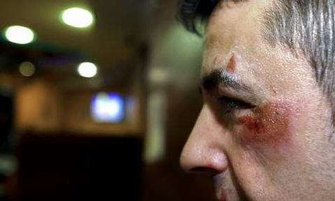 Un hostelero carballés fue agredido por dos encapuchados en la madrugada del viernes.