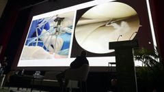 Retransmisi�n de la operarci�n de rodilla del doctor Adri�n Gallego en el Teatro Principal