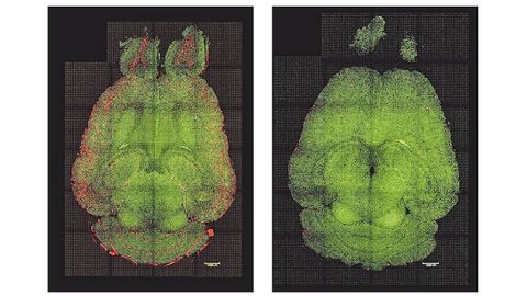 Cerebro de ratn. Alzhimer