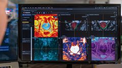 Im�genes de�paneles de biomarcadores de la empresa Quibim