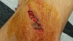 El corte en la rodilla de Marcelo D�az