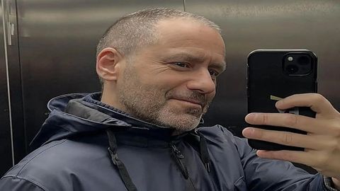 El portavoz nacional del PP y diputado en el Congreso, Borja Smper, muestra su imagen despus de pasar por un tratamiento de quimioterapia.