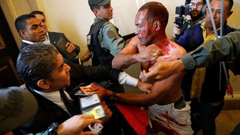 Uno de los heridos durante el asalto a la Asamblea Nacional