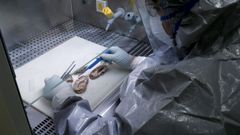 Una t�cnica analizando l�minas de un cerebro. 