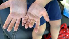 As� ti�e el suelo de caucho del parque infantil del Vila de Rutis