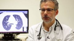 Dr. Jos� Alberto Fern�ndez Villar, jefe de Neumolog�a y responsable de la Unidad Post-COVID del Complejo Hospitalario Universitario de Vigo 