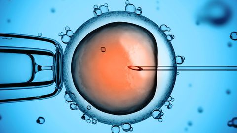 Fecundacin de un vulo a travs de un mtodo de reproduccin asistida.