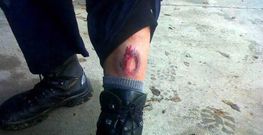 SUP.Agente herido en los entrenamientos