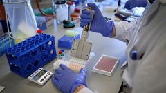 Espa�a registra 87 nuevos muertos por coronavirus, la cifra m�s baja en dos meses