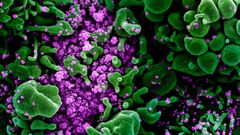 Detalle de la micrografa de una clula muy infectada por partculas del SARS-COV-2.