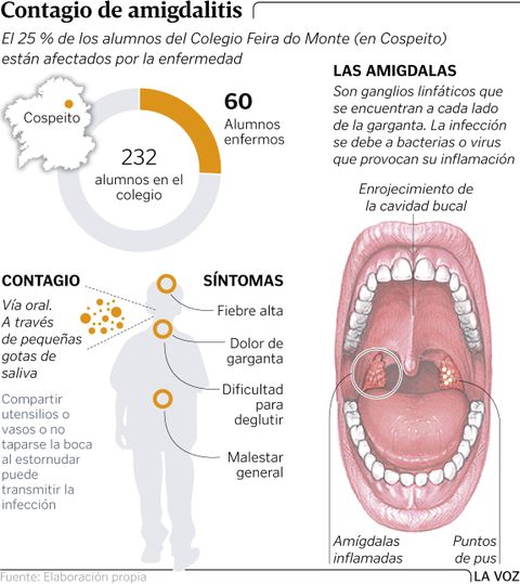 Contagio de amigdalitis