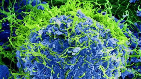 Imagen de un virus