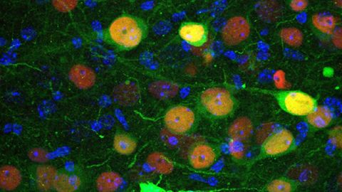 Imagen de microscopía confocal que muestra células de la amígdala basolateral