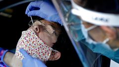 Los test PCR son fundamentales para controlar la evoluci�n de la epidemia