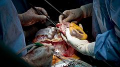 El nuevo procedimiento facilitar el trasplante de corazn en bebs