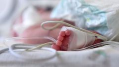 Foto de archivo de un beb� ingresado en un hospital