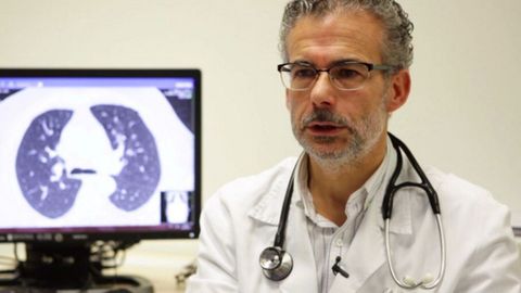 Dr. Jos� Alberto Fern�ndez Villar, jefe de Neumolog�a y responsable de la Unidad Post-COVID del Complejo Hospitalario Universitario de Vigo 