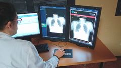 El proyecto de inteligencia artificial en radiografas se implant en el rea de Pontevedra en tres fases