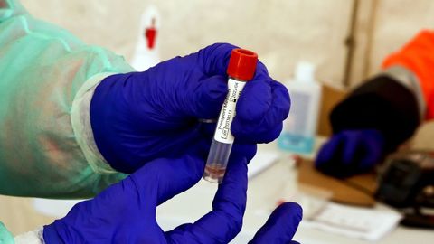 PRUEBAS DE CRIBADO MASIVO CON SALIVA EN MOAÑA PARA DETECTAR POSITIVOS