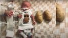Nash Keen, el beb ms prematuro del mundo, cumple su primer ao de vida