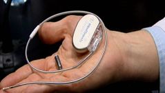 El marcapasos m�s peque�o del mundo.