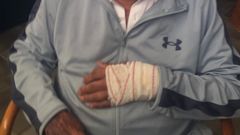 El hombre, con la mano vendada, se muestra preocupado y nervioso por lo sucedido