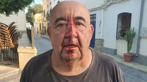 Jos Manuel Gil, el concejal de Alsodux agredido