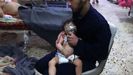 Ataque quimico enl a ciudad siria de Duma
