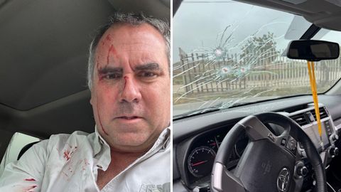 Fotograf�as tomadas de X del candidato a la presidencia de Per� Rafael Bela�nde Llosa�y de los da�os en el veh�culo en el que viajaba cuando fue atacado en Lima