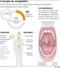 Contagio de amigdalitis