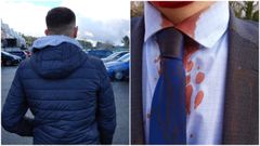 A la izquierda, �ngel Jim�nez, el empleado agredido, posando de espaldas. A la derecha, un detalle de las manchas de sangre en su traje tras la agresi�n