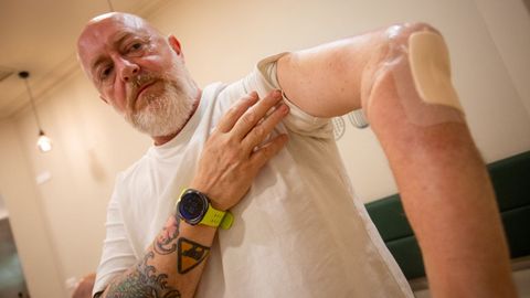 David Vega, este mi&eacute;rcoles en Pontevedra, muestra su maltrecho brazo izquierdo, a la espera de una operaci&oacute;n de prioridad 2 para retirar el hueso y ponerle una pr&oacute;tesis