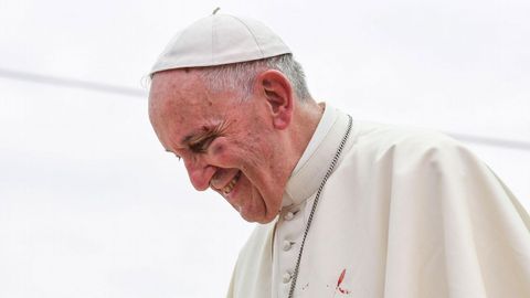 El pont�fice sufri� un peque�o golpe en la ceja y el p�mulo izquierdo al intentar saludar a un ni�o durante el recorrido en el papam�vil 