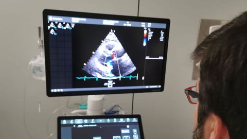 Un m�dico maneja un ec�grafo cardiovascular en un hospital.