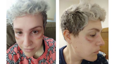 El resultado de llevar el EPI puesto