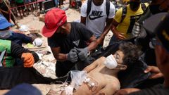 Los equipos de rescate asisten a un joven despu�s de sacarlo de los escombros