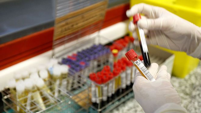 Imagen de archivo de una sala de extracciones y de an&aacute;lisis de sangre.