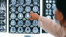 Imagen de archivo de resonancias magn�ticas del cerebro