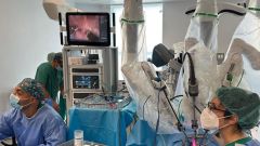 Cirug�a rob�tica en el Hospital de Cabue�es de Gij�n