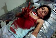 Una imagen distribuida por la oposici�n muestra a una joven herida, cerca de Homs.