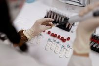 El nuevo test sera m�s fiable que las pruebas rapidas de anticuerpos