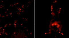 Los puntos iluminados indican falta de ox�geno en las c�lulas, un indicador de las c�lulas tumorales
