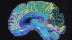 Imagen de la radiograf�a de un cerebro.